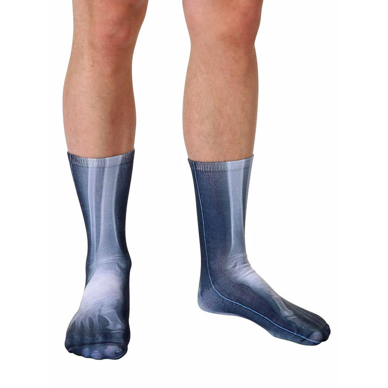 Load image into Gallery viewer, X-Ray
