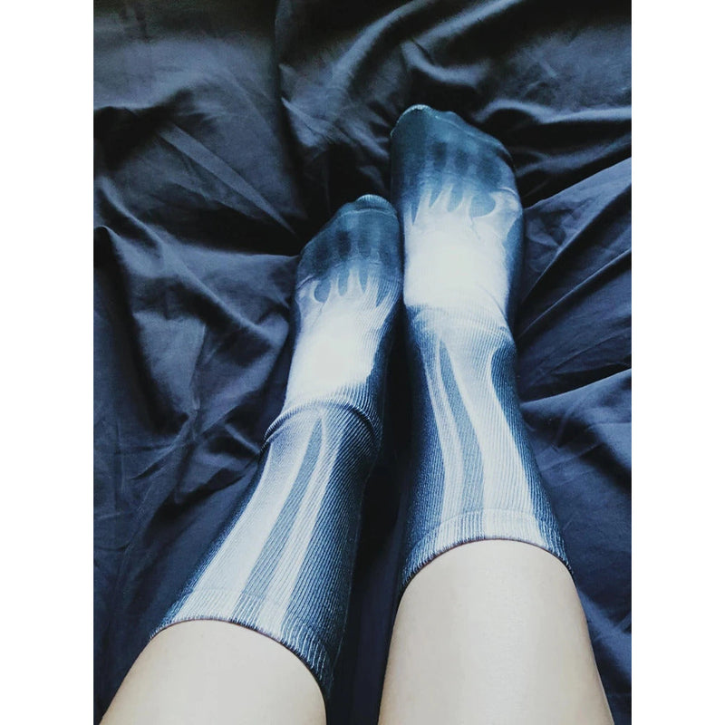 Load image into Gallery viewer, X-Ray
