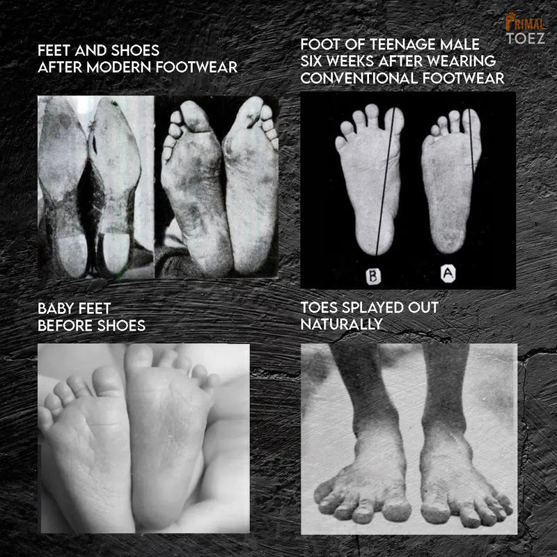 Load image into Gallery viewer, Primal Toez™ 'Solo Spacers'
